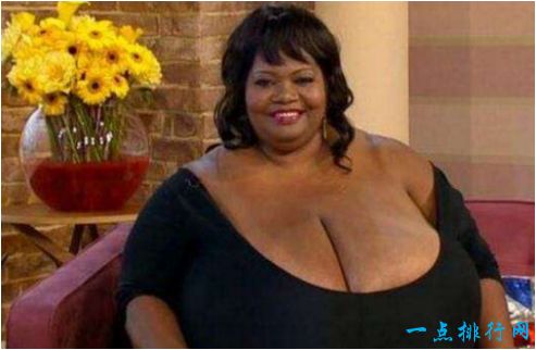 世界上最大的天然乳房 安妮·霍金斯·特纳双乳重达35.8公斤