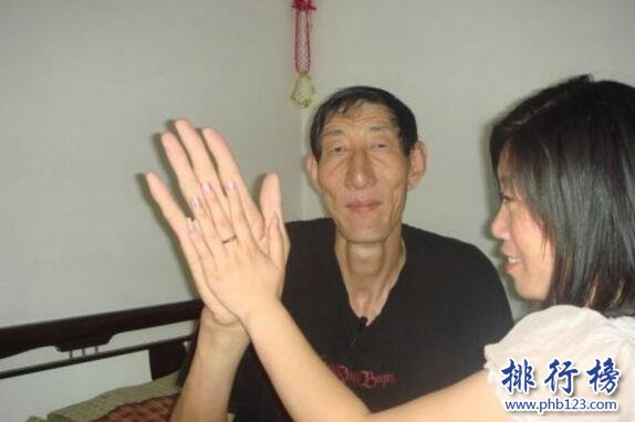 世界上最长的手：鲍喜顺手掌长38厘米，如蒲扇般大小
