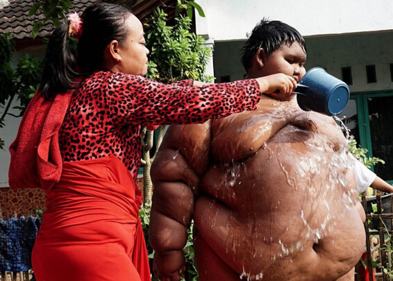 世界上最胖的孩子，印尼十岁男孩体重惊人(192公斤)