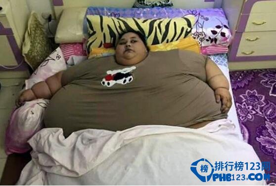 【组图】世界上最胖的女人,埃及女子25年卧床不起(重达半吨)