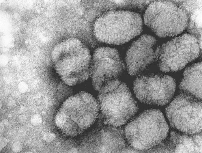 世界十大疾病排行榜 流感导致一亿人死亡