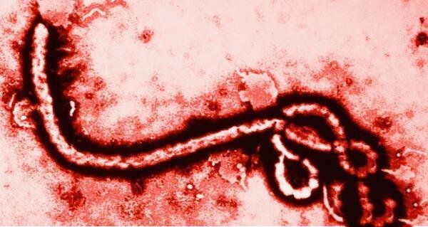 世界上最最危险的几个病毒：马尔堡病毒上榜
