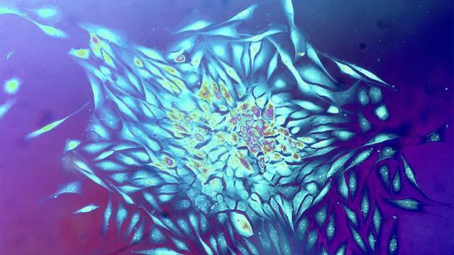2020世界十大科技进展新闻，人造叶绿体研制成功