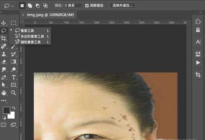 PS简单的给人物祛斑