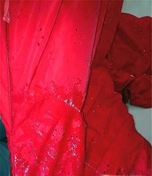 粘鼠板粘到衣服怎么洗