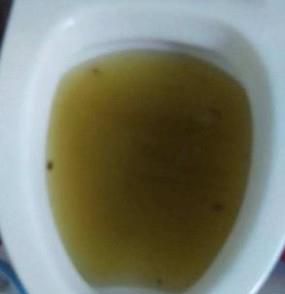 马桶堵了怎么办？一种简易疏通法