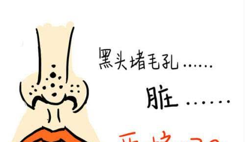 脸上黑头除不掉怎么办，鼻贴去黑头有用吗？