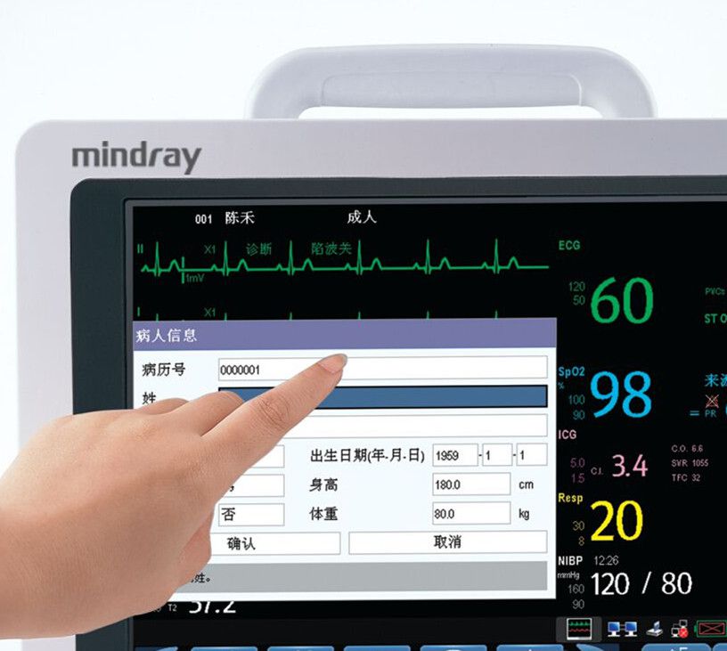 监护仪上的RESP代表什么？