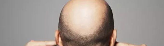 聪明与“绝顶”真的有关系吗？