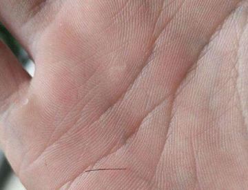 头发能不能扎进肉里？