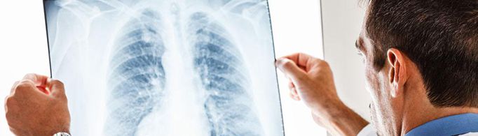 为什么X射线能拍出骨骼和牙齿的照片?