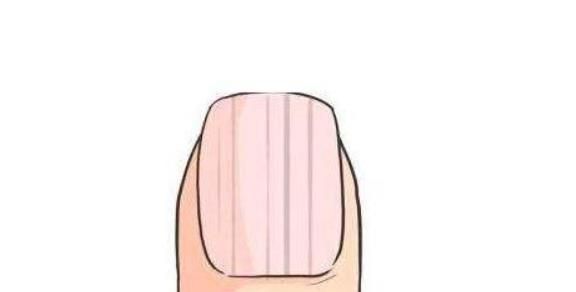 大拇指指甲上有竖纹是怎么回事?