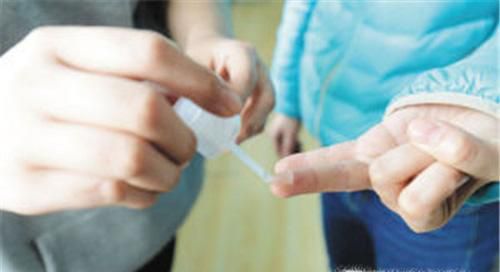 手上沾了502胶水怎么办