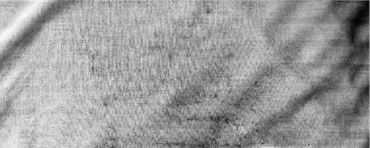 衣服发霉了怎么办