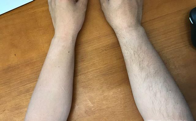 用脱毛膏的利弊