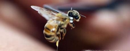 被蜂子蛰了怎么办