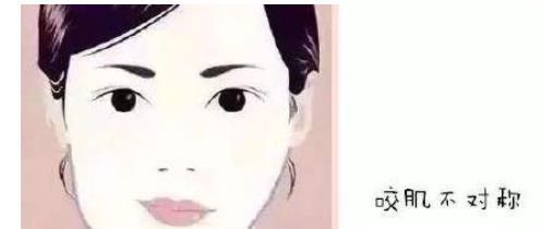 左右脸不对称怎么办