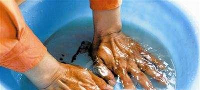 切辣椒手被辣到如何快速消除痛感