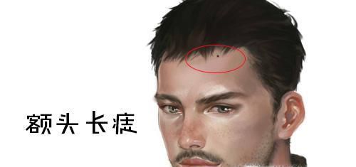 从身上痣,看运势祸福全集