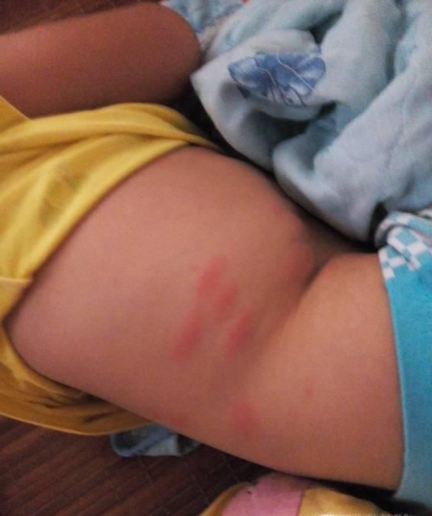 怎么彻底消灭家里的跳蚤