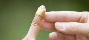 玻璃纤维扎到手上