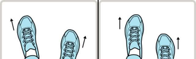 如何纠正走路外八字脚