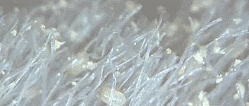 清除面部螨虫的省钱小妙招