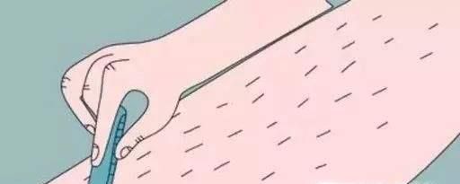 女生腿毛怎么永久去除