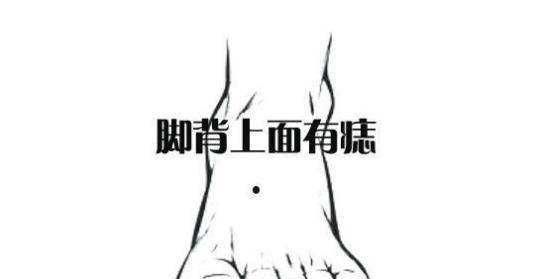 全面解析脚上的痣