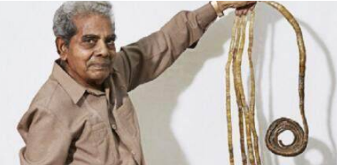 世界上最长的指甲