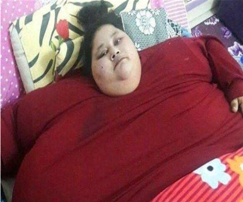 世界最胖的女人