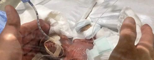 世界上最小的婴儿