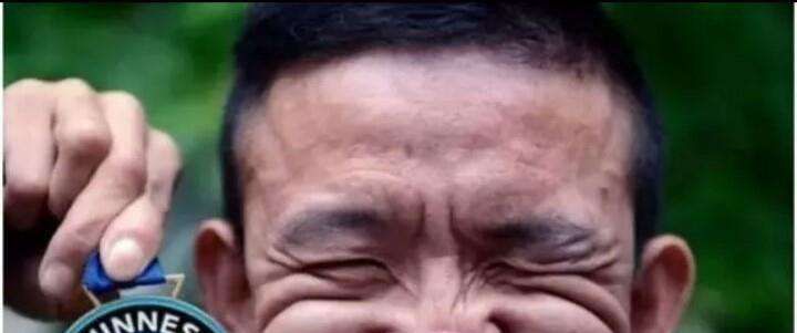 世界上最丑的人