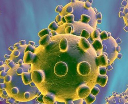 非典是什么地方引起的?