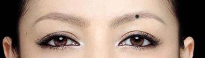 眉毛里有痣代表什么？