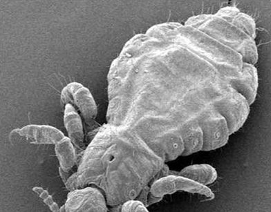 虱子是怎么产生的？