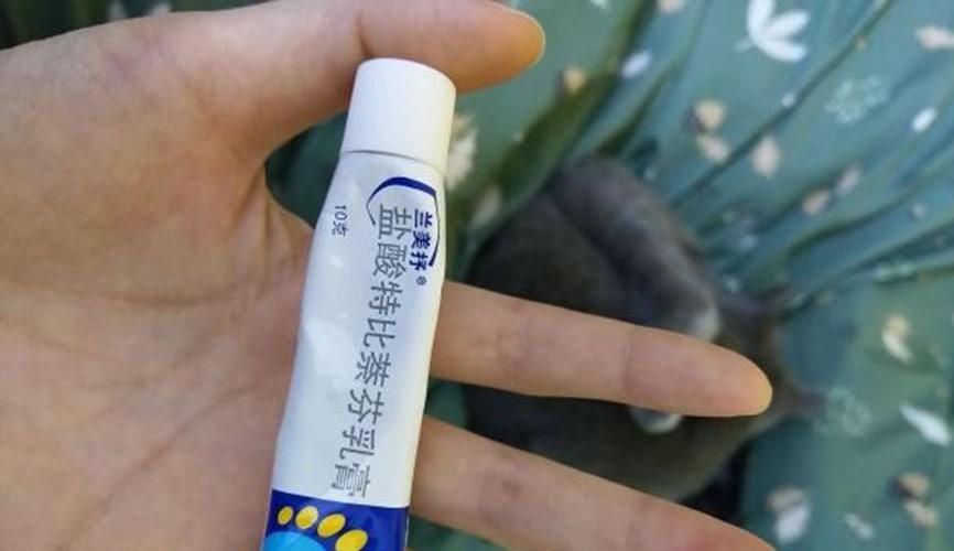 猫癣传染人应该如何处理