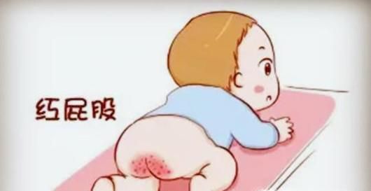 夏季宝宝出现红屁股是怎么回事？该如何治疗？