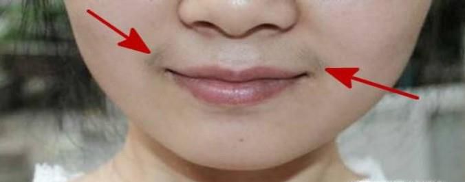 女生长胡子怎么办 女孩子怎么去除小胡子