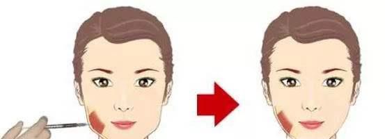 瘦脸针多少钱一针，瘦脸针能保持多久