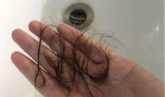 怎么算是脱发