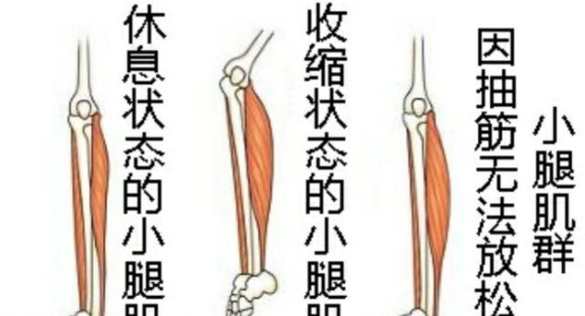 为什么会半夜突然小腿抽筋？是身体缺什么的征兆？