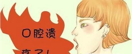 猕猴桃对治疗口腔溃疡有奇效
