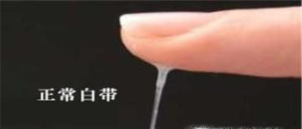 白带增多，外阴瘙痒是得了阴道炎吗？