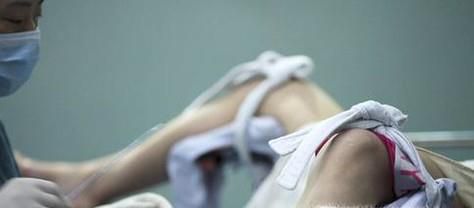 人工人流和无痛人流的区别有哪些