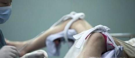 不同流产方式对于时间有什么要求