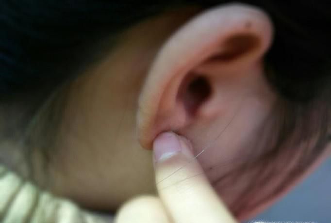 耳洞臭臭的怎么清洁