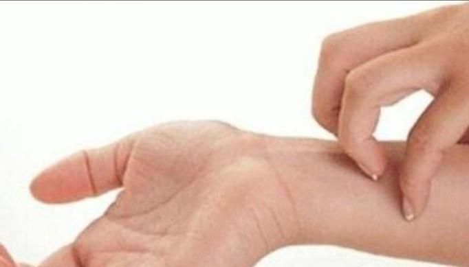 皮肤瘙痒是否患有了湿疹