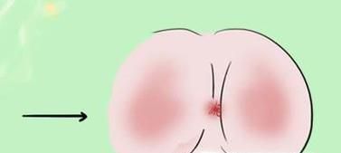 儿童肛门瘙痒是怎么回事