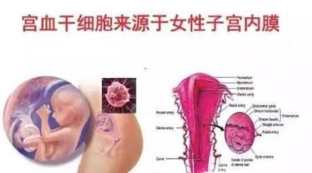 宫血干细胞可以治疗哪些疾病？